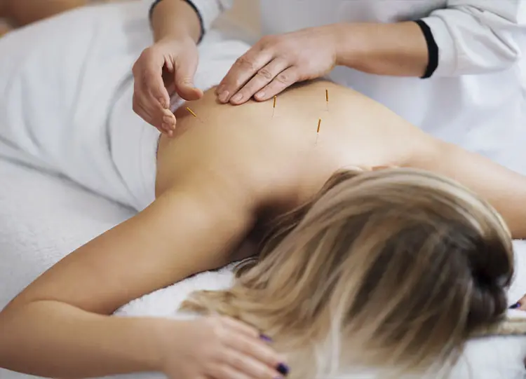 Medicine complementari: omeopatia e agopuntura